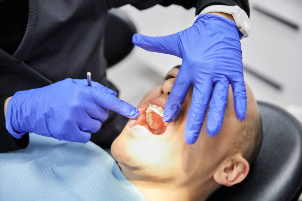 Best Emergency Wisdom Tooth Extraction in North Scituate, MA